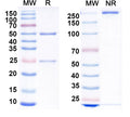SDS-PAGE for Anti-GluN2D/NR2D glutamate receptor Antibody (N437/9)