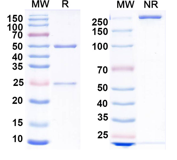 SDS-PAGE for Anti-GluN2D/NR2D glutamate receptor Antibody (N437/9)