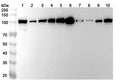 Western blot analysis was performed using anti-ACTN4  polyclonal antibody at ACTN4  on various samples.
Lane 1: Hela cell lysate
Lane 2: Jurkat cell lysate
Lane 3: 293T  cell lysate
Lane 4: NIH3T3 cell lysate
Lane 5: A431 cell lysate
Lane 6: Mouse brain lysate
Lane 7: Mouse heart lysate
Lane 8: Mouse skeletal muscle lysate
Lane 9: Mouse kidney lysate
Lane 10: Rat brain lysate