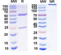 SDS-PAGE for Anti-Complex spinal cord protein sample Antibody (L7/3)