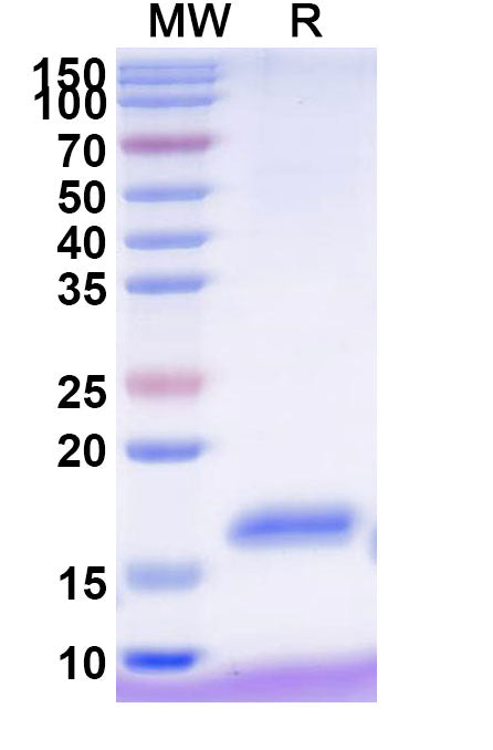 SDS-PAGE for Anti-Human CD337/NKp30 Nanobody (VHH2)