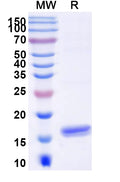 SDS-PAGE for Anti-Human ANGPT2/Ang2 Nanobody (SAA1255)