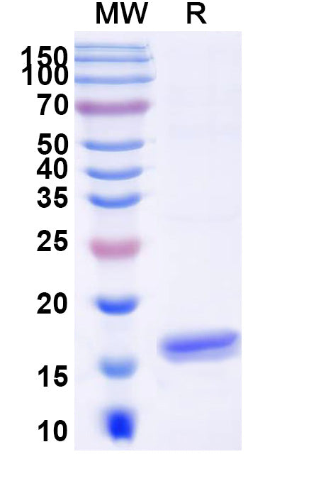 SDS-PAGE for Anti-Human ANGPT2/Ang2 Nanobody (SAA1255)