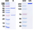 Anti-Human Angiopoietin-2 Reference Antibody (Zansecimab) – Figure 1 of 1