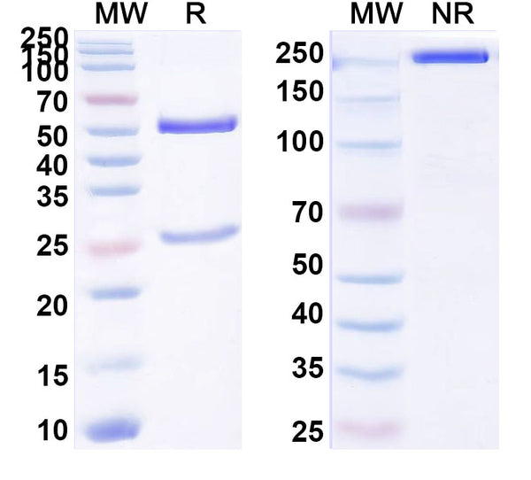 SDS-PAGE for Anti-Human CCL21/6Ckine Antibody (SAA1498)