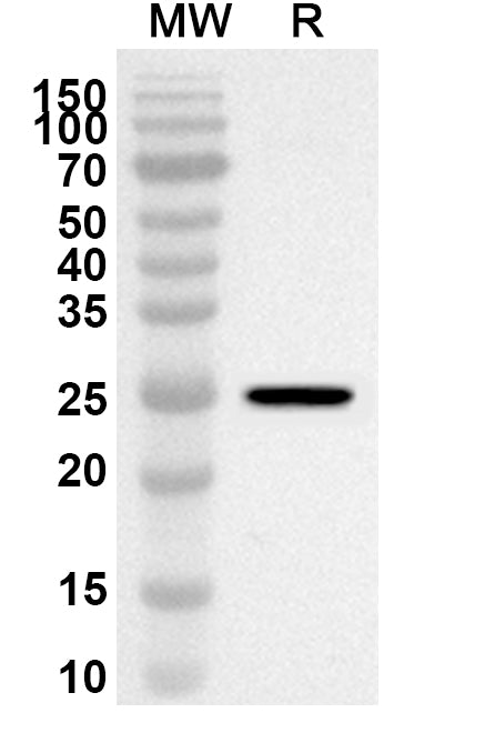 Western blot analysis was performed using anti-ALOX15B polyclonal antibody at 1ug/mL on recombinant ALOX15B (Catalog No. HT104022).