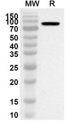 Western blot analysis was performed using anti-Human AKAP8 polyclonal antibody at 1ug/mL on recombinant Human AKAP8 (Catalog No. HT110012).