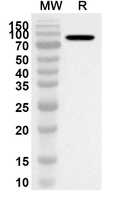 Western blot analysis was performed using anti-Human AKAP8 polyclonal antibody at 1ug/mL on recombinant Human AKAP8 (Catalog No. HT110012).