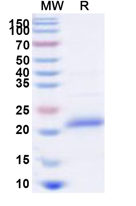 Recombinant Human TNFRSF10C Protein, N-His