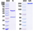 SDS-PAGE for Anti-Human CD263/TNFRSF10C Antibody (SAA1500)