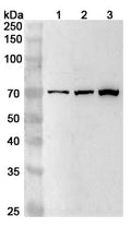 Western blot analysis was performed using anti-DVL1 polyclonal antibody at 1ug/mL on various samples.
Lane 1: MCF-7 cell lysate
Lane 2: Hela cell lysate
Lane 3: PC-3 cell lysate