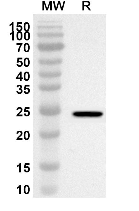 Western blot analysis was performed using anti-DVL1 polyclonal antibody at 1ug/mL on recombinant DVL1 (Catalog No. HT161022).