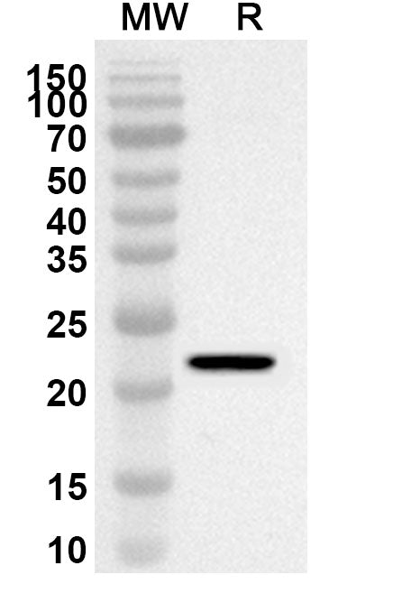 Western blot analysis was performed using anti-Human LAMA5 polyclonal antibody at 1ug/mL on recombinant Human LAMA5 (Catalog No. HT189012).