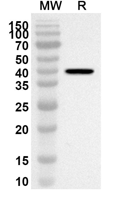 Western blot analysis was performed using anti-NARS1 polyclonal antibody at 1ug/mL on recombinant NARS1 (Catalog No. HT196012).