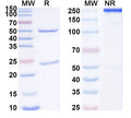 SDS-PAGE for Anti-GABA(A)R, Delta Antibody (N151/3)