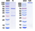 SDS-PAGE for Anti-GABA(A)R, Delta Antibody (N453/84)