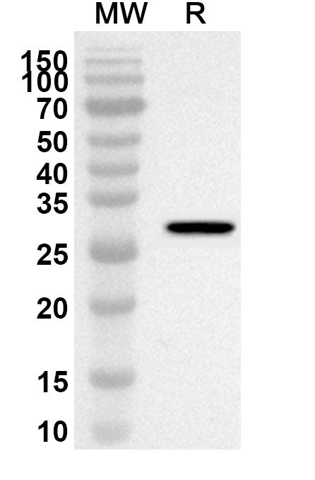 Western blot analysis was performed using anti-PDHX polyclonal antibody at 1ug/mL on recombinant PDHX (Catalog No. HT217012).