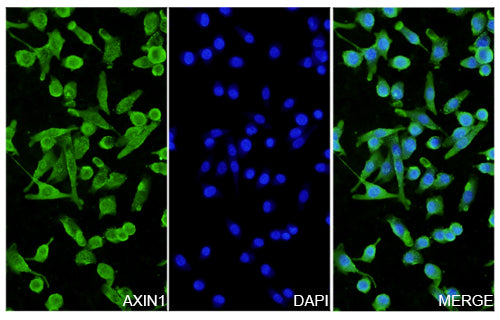 A549 cells were fixed with 4% paraformaldehyde for 20 minutes, followed by blocking with 5% goat serum for 1 hour. The cells were then incubated with a primary antibody targeting AXIN1 (HT232014) at a concentration of 13.5 ug/ml overnight at 4°C. Afterward, the cells were incubated with a secondary antibody, Goat Anti-Rabbit IgG (Alexa Fluor-488) for 50 minutes at room temperature. The localization of AXIN1 was visualized (shown in green), and nuclear DNA was stained with DAPI (shown in blue).