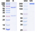 SDS-PAGE for Anti-CCRL2 Antibody (N184/1)