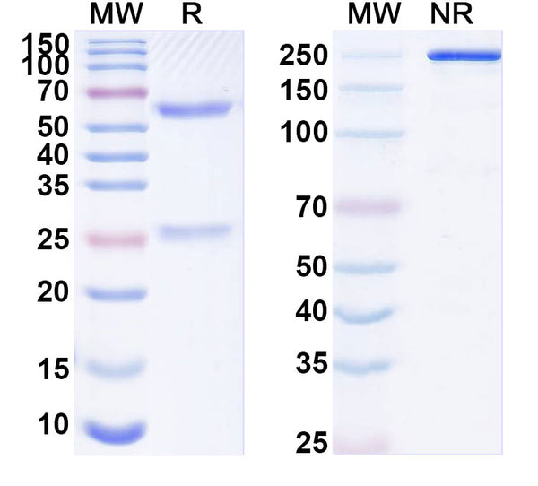 SDS-PAGE for Anti-CCRL2 Antibody (N184/1)