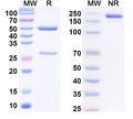 SDS-PAGE for Anti-Human SKB1/PRMT5 IP Antibody (SAA0228)