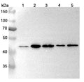 Western blot analysis was performed using anti-PSMD9 polyclonal antibody at 1μg/ml on various samples.
Lane 1: NIH3T3 cell lysate
Lane 2: HepG2 cell lysate
Lane 3: K562 cell lysate
Lane 4: Lncap cell lysate
Lane 5: Hela cell lysate