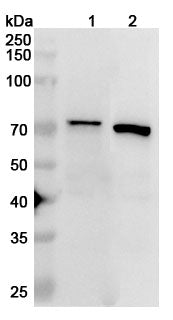 Western blot analysis was performed using anti-IGF2BP3 polyclonal antibody at 1ug/mL on various samples.
Lane 1: NIH3T3 cell lysate
Lane 2: K562 cell lysate
