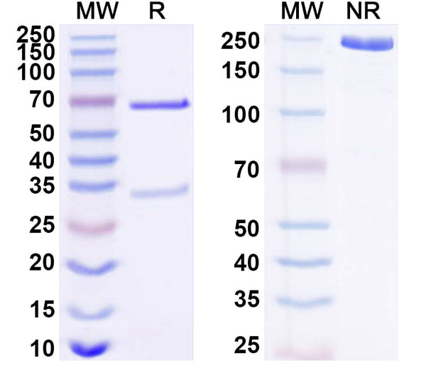 SDS-PAGE for Anti-Human LAMTOR5/HBXIP Monoclonal Antibody (1A071)