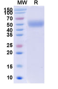 Recombinant Human CD172b/SIRPB1 Protein, C-His