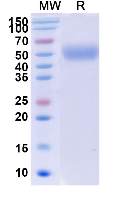 Recombinant Human CD172b/SIRPB1 Protein, C-His