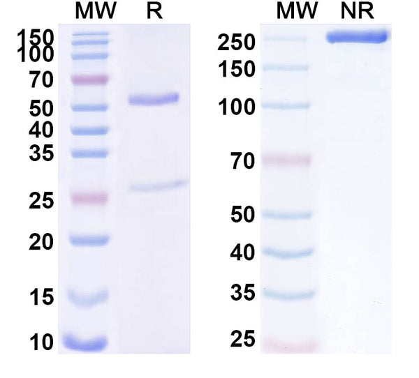 SDS-PAGE for Anti-Human CD172b/SIRPB1 Antibody (SAA1734)
