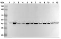 Western blot analysis was performed using anti-SIRPB1 polyclonal antibody at 1ug/mL on various samples.
Lane 1: U937 cell lysate
Lane 2: PC-3 cell lysate
Lane 3: A549 cell lysate
Lane 4: HUVEC cell lysate
Lane 5: Hela cell lysate
Lane 6: Jurkat cell lysate
Lane 7: Mouse brain lysate
Lane 8: Mouse heart lysate
Lane 9: Mouse cerebellum lysate
Lane 10: Rat brain lysate
Lane11: Rat heart lysate
Lane12: Rat cerebellum lysate