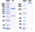 SDS-PAGE for Anti-Parkin Antibody (N137/14)