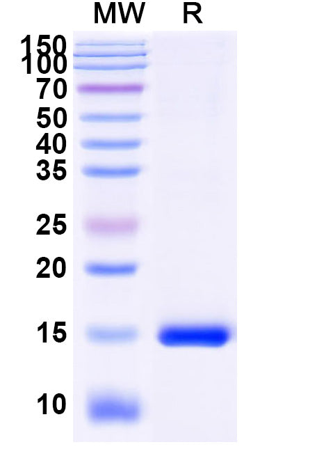 SDS-PAGE for Anti-Human MDM4 Nanobody (SAA1189)