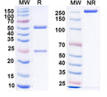 SDS-PAGE for Anti-Human TIF1/TRIM24 IP Antibody (SAA0265)