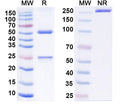 SDS-PAGE for Anti-Human CBX4 Antibody (P004)