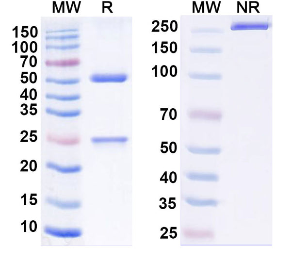 SDS-PAGE for Anti-Human CBX4 Antibody (P004)