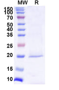 SDS-PAGE for Anti-Human BIRC5 Nanobody (SAA1237)