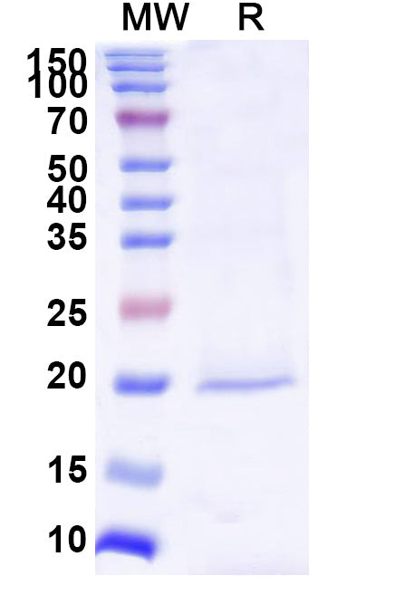 SDS-PAGE for Anti-Human BIRC5 Nanobody (SAA1237)