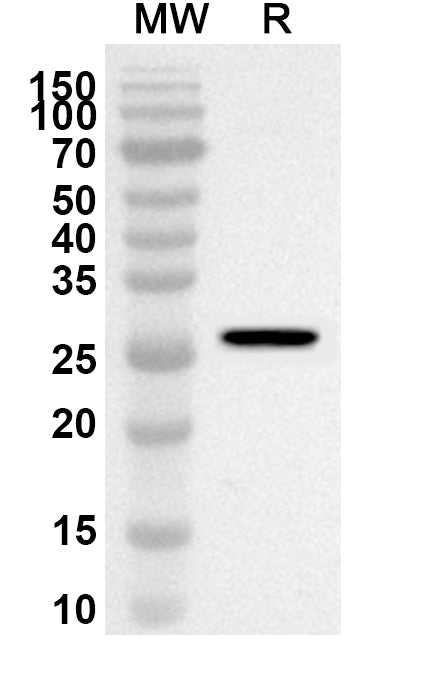 Western blot analysis was performed using anti-Human IFITM5 polyclonal antibody at 1ug/mL on recombinant Human IFITM5 (Catalog No. HT338012).