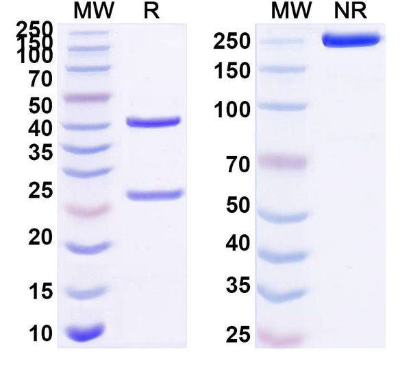 SDS-PAGE for Anti-Human CD327/SIGLEC6 Antibody (SAA1503)