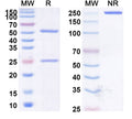 Anti-Human TRAIL R2/TNFRSF10B Reference Antibody (Tigatuzumab) – Figure 1 of 3
