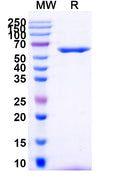 Anti-Human CD262/TNFRSF10B/TRAIL-R2/DR5 Reference Antibody (TAS266) – Figure 1 of 2