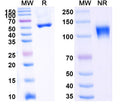 Anti-Human CD262/TRAIL-R2/DR5 Reference Antibody (Ozekibart) – Figure 1 of 1