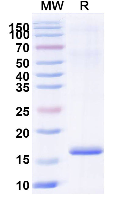SDS-PAGE for Anti-Human MAPK13 Nanobody (SAA1368)