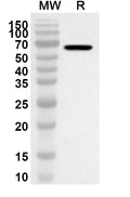 Western blot analysis was performed using anti-Human AP1G1 polyclonal antibody at 1ug/mL on recombinant Human AP1G1 (Catalog No. HT368012).