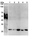 Western blot analysis was performed using anti-PSMA7 polyclonal antibody at 1μg/ml on various samples.
Lane 1: HepG2 cell lysate
Lane 2: Lncap cell lysate
Lane 3: Jurkat cell lysate
Lane 4: Mouse liver lysate
Lane 5: Mouse lung lysate