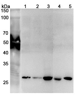 Western blot analysis was performed using anti-PSMA7 polyclonal antibody at 1μg/ml on various samples.
Lane 1: HepG2 cell lysate
Lane 2: Lncap cell lysate
Lane 3: Jurkat cell lysate
Lane 4: Mouse liver lysate
Lane 5: Mouse lung lysate