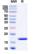 SDS-PAGE for Anti-Human CXCL11/I-TAC Nanobody (SAA1272).
