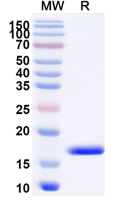 SDS-PAGE for Anti-Human CXCL11/I-TAC Nanobody (SAA1272).